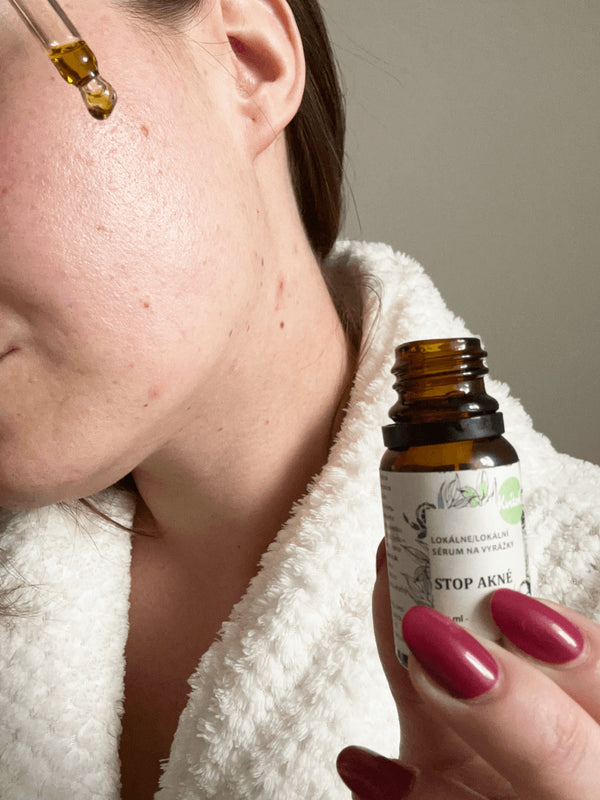 Kvitok SOS lokálne sérum STOP akné (10 ml)