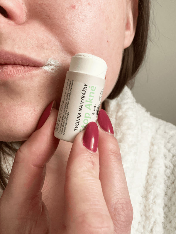 Kvitok SOS Zinková tyčinka na pupienky a opary (8 ml)